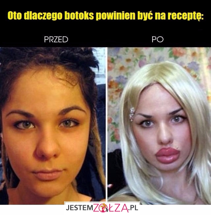 Botoks na receptę?