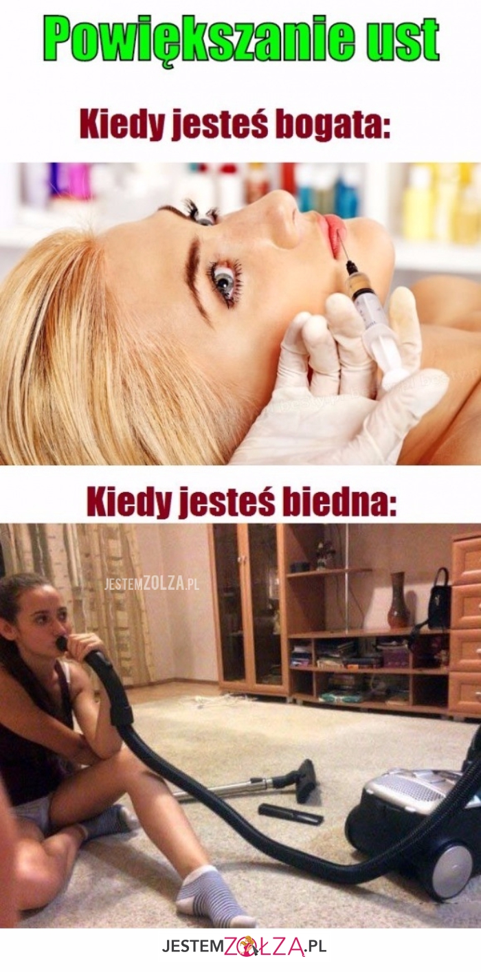 Powiększanie ust